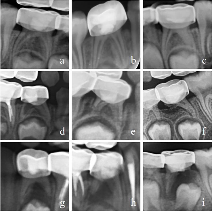https://cdn.ncbi.nlm.nih.gov/pmc/blobs/eaa6/11566509/95c9496aa090/peerj-12-18453-g003.jpg