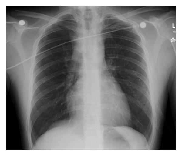 https://cdn.ncbi.nlm.nih.gov/pmc/blobs/eaa8/3728538/bd5f6b3bbd0b/CRIM.EM2013-728405.001.jpg