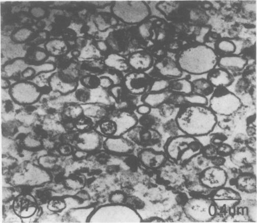 https://cdn.ncbi.nlm.nih.gov/pmc/blobs/eab2/542994/9251d6e07d2c/plntphys00127-0218-b.jpg