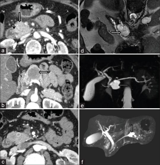 https://cdn.ncbi.nlm.nih.gov/pmc/blobs/eab4/6844018/7aa4a01ec9a3/JCytol-36-189-g003.jpg