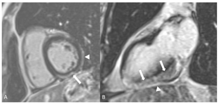 https://cdn.ncbi.nlm.nih.gov/pmc/blobs/eab6/11049623/2b1a6927bf60/diagnostics-14-00838-g013.jpg