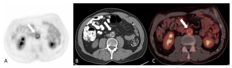 https://cdn.ncbi.nlm.nih.gov/pmc/blobs/eab6/11049623/2fc877d8a413/diagnostics-14-00838-g014.jpg