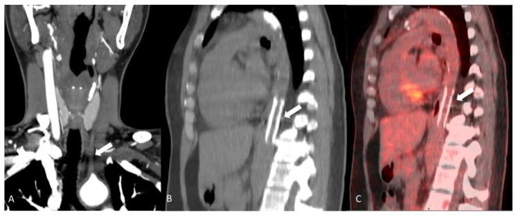 https://cdn.ncbi.nlm.nih.gov/pmc/blobs/eab6/11049623/3944edd42aac/diagnostics-14-00838-g006.jpg