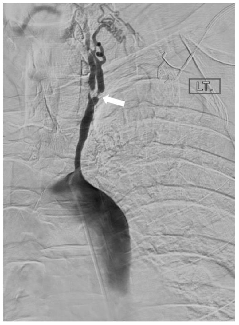 https://cdn.ncbi.nlm.nih.gov/pmc/blobs/eab6/11049623/5bebc2f111ff/diagnostics-14-00838-g007.jpg