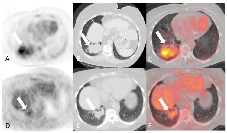 https://cdn.ncbi.nlm.nih.gov/pmc/blobs/eab6/11049623/67afd0233037/diagnostics-14-00838-g011.jpg