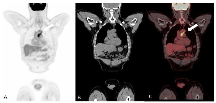 https://cdn.ncbi.nlm.nih.gov/pmc/blobs/eab6/11049623/929902bbad3f/diagnostics-14-00838-g003.jpg