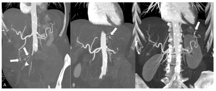 https://cdn.ncbi.nlm.nih.gov/pmc/blobs/eab6/11049623/94f170779641/diagnostics-14-00838-g008.jpg