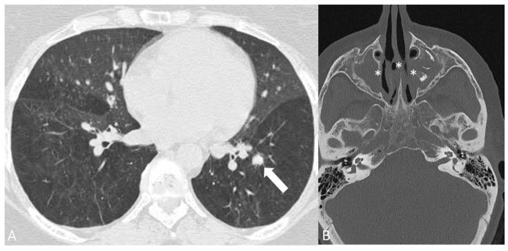 https://cdn.ncbi.nlm.nih.gov/pmc/blobs/eab6/11049623/ba369be98ff5/diagnostics-14-00838-g010.jpg