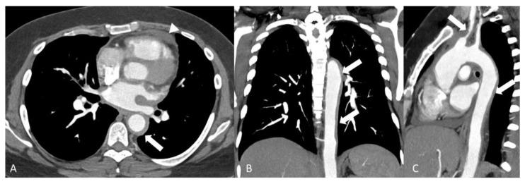 https://cdn.ncbi.nlm.nih.gov/pmc/blobs/eab6/11049623/d80830b27781/diagnostics-14-00838-g005.jpg