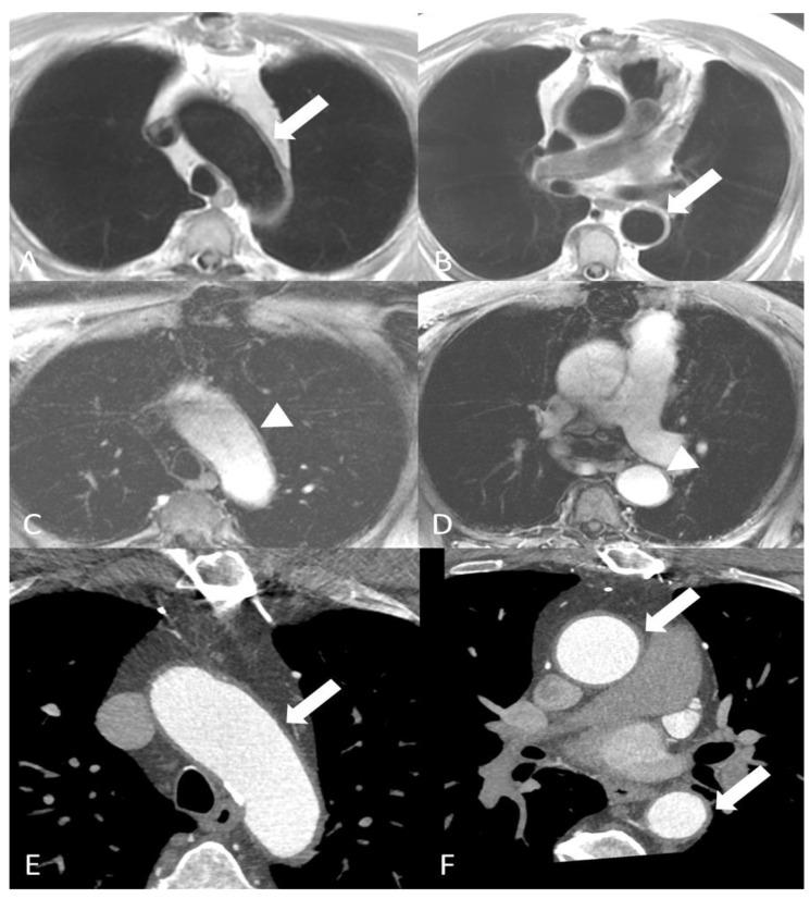 https://cdn.ncbi.nlm.nih.gov/pmc/blobs/eab6/11049623/d9cdde511538/diagnostics-14-00838-g002.jpg
