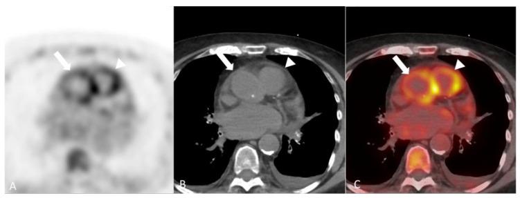 https://cdn.ncbi.nlm.nih.gov/pmc/blobs/eab6/11049623/e1c2bfecd2d9/diagnostics-14-00838-g012.jpg