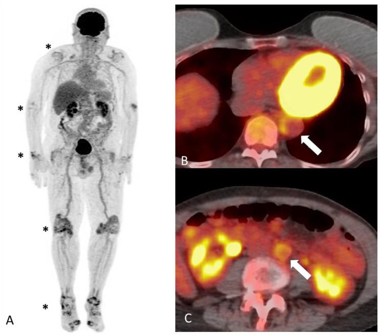 https://cdn.ncbi.nlm.nih.gov/pmc/blobs/eab6/11049623/e84fffc2fa9d/diagnostics-14-00838-g004.jpg