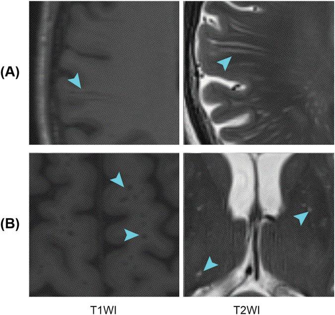 https://cdn.ncbi.nlm.nih.gov/pmc/blobs/eaba/11390432/58e86409c6b4/fnagi-16-1457405-g001.jpg