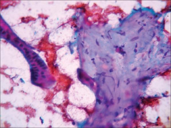 https://cdn.ncbi.nlm.nih.gov/pmc/blobs/eaba/3391802/f86f0546f84a/JCytol-29-149-g002.jpg