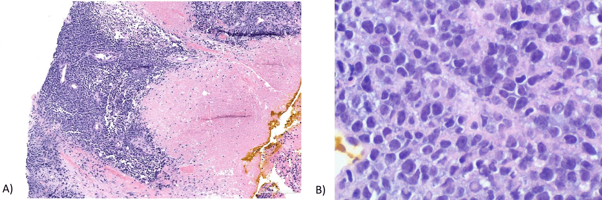 https://cdn.ncbi.nlm.nih.gov/pmc/blobs/eac7/10614416/5d1b49b5e063/13256_2023_4192_Fig5_HTML.jpg