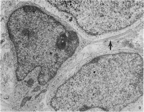 https://cdn.ncbi.nlm.nih.gov/pmc/blobs/eac7/1232966/80f629c3ef34/janat00241-0129-a.jpg