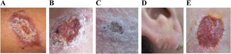 https://cdn.ncbi.nlm.nih.gov/pmc/blobs/ead0/9248147/ecfd64fc3d76/40794_2022_171_Fig1_HTML.jpg