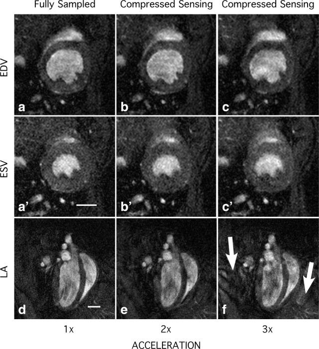 https://cdn.ncbi.nlm.nih.gov/pmc/blobs/eadc/3261377/b6bbb8698775/jmri0034-1072-f6.jpg