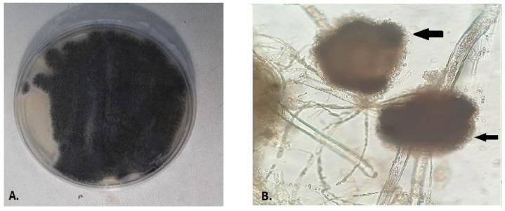https://cdn.ncbi.nlm.nih.gov/pmc/blobs/eadd/8944507/1128b50c8ee7/antibiotics-11-00300-g001.jpg