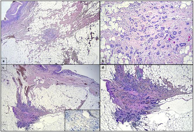 https://cdn.ncbi.nlm.nih.gov/pmc/blobs/eadf/7985528/88501c0ce0e1/fsurg-08-606864-g0002.jpg