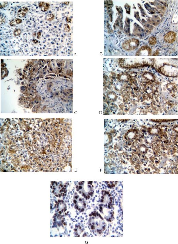 https://cdn.ncbi.nlm.nih.gov/pmc/blobs/eae2/3129111/bd954ee047d4/JRMS-14-239-g001.jpg
