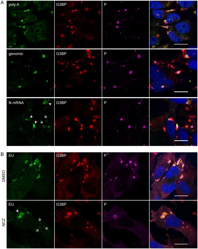 https://cdn.ncbi.nlm.nih.gov/pmc/blobs/eaed/5066959/80c0bc75fe4a/ppat.1005942.g008.jpg