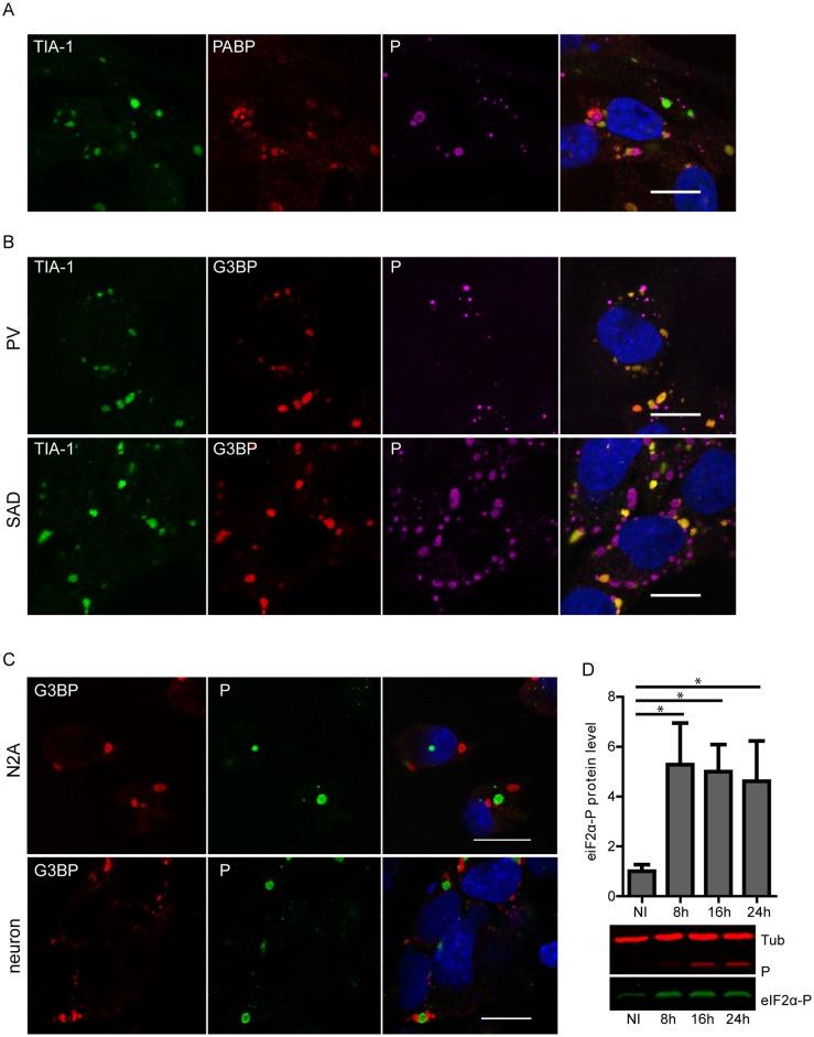 https://cdn.ncbi.nlm.nih.gov/pmc/blobs/eaed/5066959/d0c853c9a32d/ppat.1005942.g002.jpg
