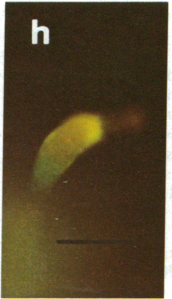 https://cdn.ncbi.nlm.nih.gov/pmc/blobs/eaf5/383959/8c1eabddae19/pnas00008-0415-f.jpg