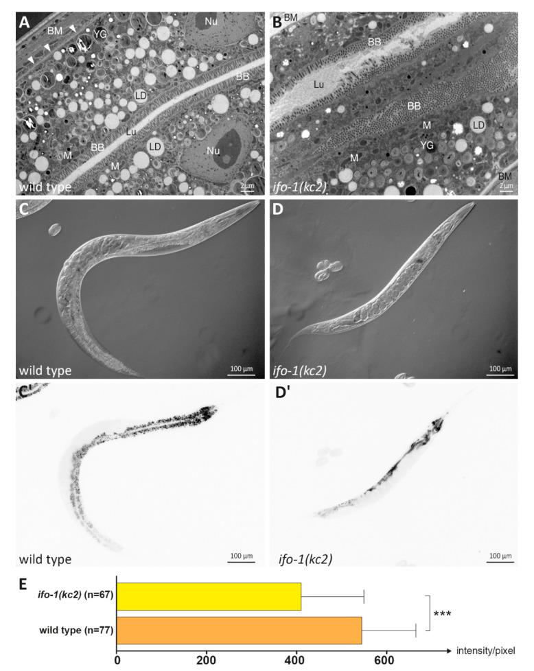 https://cdn.ncbi.nlm.nih.gov/pmc/blobs/eafc/7672635/07c8ae1a1517/ijms-21-08219-g001.jpg