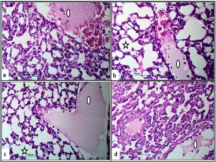 https://cdn.ncbi.nlm.nih.gov/pmc/blobs/eb0d/12052906/d5c2db31f263/fcimb-15-1493769-g004.jpg