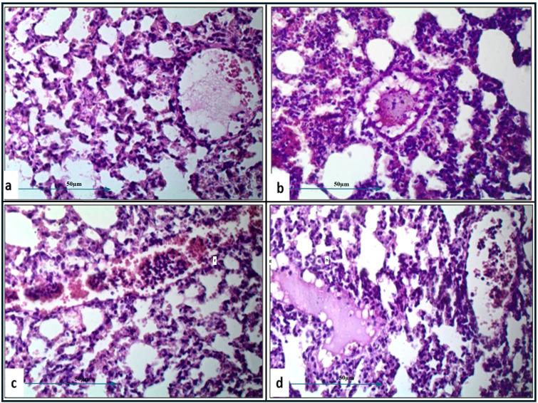https://cdn.ncbi.nlm.nih.gov/pmc/blobs/eb0d/12052906/ea8485dde3fe/fcimb-15-1493769-g005.jpg