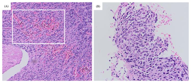 https://cdn.ncbi.nlm.nih.gov/pmc/blobs/eb11/9249417/c15272da06b8/04mjms2903_oaf6.jpg