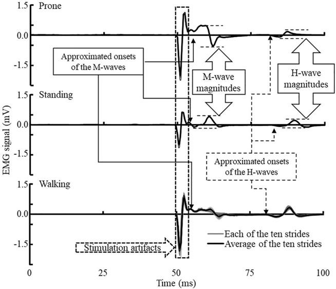 https://cdn.ncbi.nlm.nih.gov/pmc/blobs/eb11/9277460/2de19b84a804/fphys-13-890414-g002.jpg
