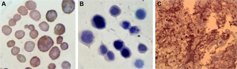 https://cdn.ncbi.nlm.nih.gov/pmc/blobs/eb16/5789074/ab06cb37b5b0/ijn-13-493Fig2.jpg