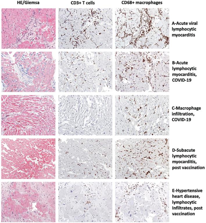 https://cdn.ncbi.nlm.nih.gov/pmc/blobs/eb17/9538893/c271d8359a7d/EJHF-9999-0-g005.jpg