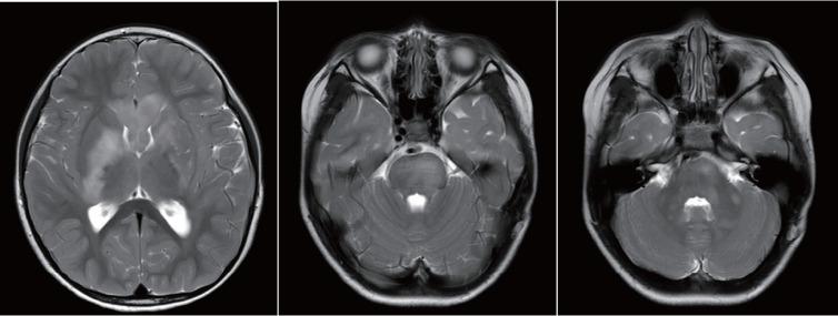https://cdn.ncbi.nlm.nih.gov/pmc/blobs/eb25/12062527/463861269f83/jkns-2025-0057f4.jpg