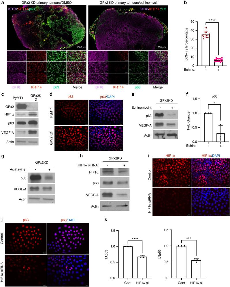 https://cdn.ncbi.nlm.nih.gov/pmc/blobs/eb2a/10951347/74148798c866/41416_2023_2522_Fig7_HTML.jpg
