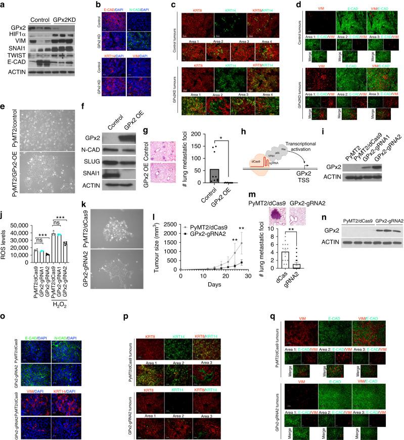 https://cdn.ncbi.nlm.nih.gov/pmc/blobs/eb2a/10951347/a8f459dfdbc8/41416_2023_2522_Fig2_HTML.jpg