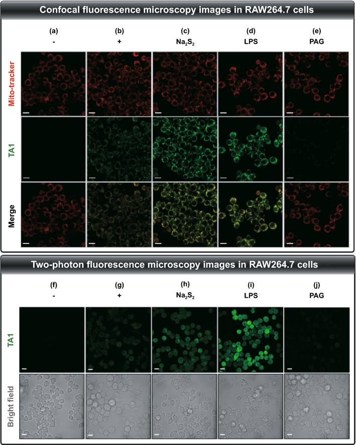 https://cdn.ncbi.nlm.nih.gov/pmc/blobs/eb2c/8342730/1d246c994bab/40820_2021_689_Fig3_HTML.jpg