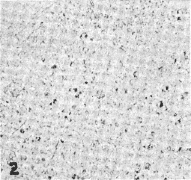 https://cdn.ncbi.nlm.nih.gov/pmc/blobs/eb2f/2035359/45e5f3d4b0ff/brmedj03175-0019-b.jpg