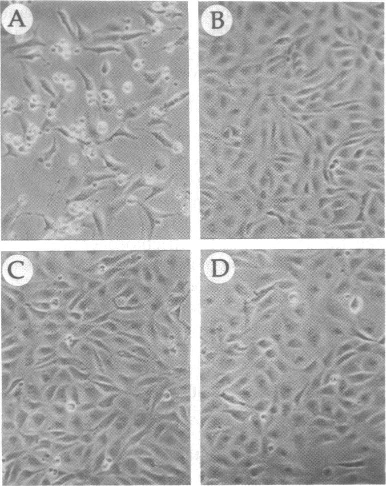 https://cdn.ncbi.nlm.nih.gov/pmc/blobs/eb32/51295/68677aae387a/pnas01057-0047-a.jpg