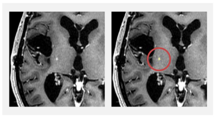 https://cdn.ncbi.nlm.nih.gov/pmc/blobs/eb39/9914320/9864d71ace35/diagnostics-13-00363-g006.jpg
