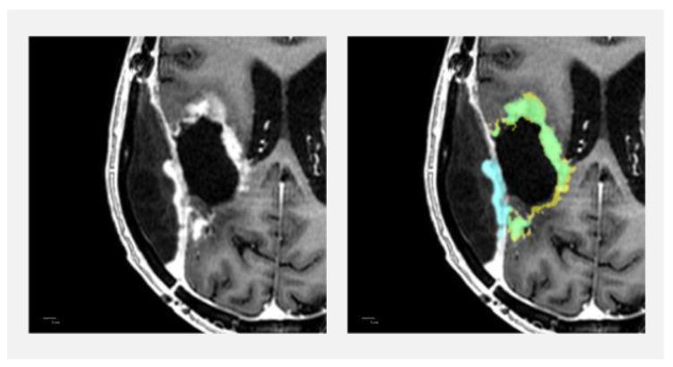 https://cdn.ncbi.nlm.nih.gov/pmc/blobs/eb39/9914320/9dae61973ab5/diagnostics-13-00363-g007.jpg