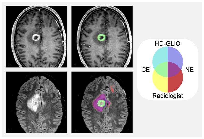 https://cdn.ncbi.nlm.nih.gov/pmc/blobs/eb39/9914320/f21b191ad1ea/diagnostics-13-00363-g003.jpg