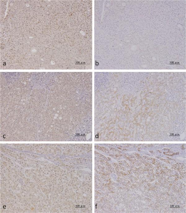 https://cdn.ncbi.nlm.nih.gov/pmc/blobs/eb3d/4235016/ee6b57cb7a04/1471-2407-13-572-1.jpg