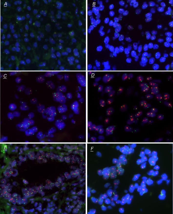 https://cdn.ncbi.nlm.nih.gov/pmc/blobs/eb44/11798095/e0c16b7bfbcf/432_2022_4230_Fig2_HTML.jpg