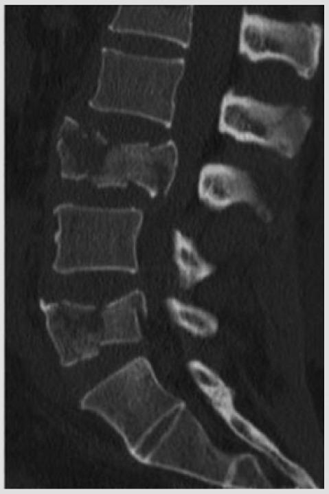 https://cdn.ncbi.nlm.nih.gov/pmc/blobs/eb46/5414848/3820efd1ad7e/eor-1-332-g001.jpg