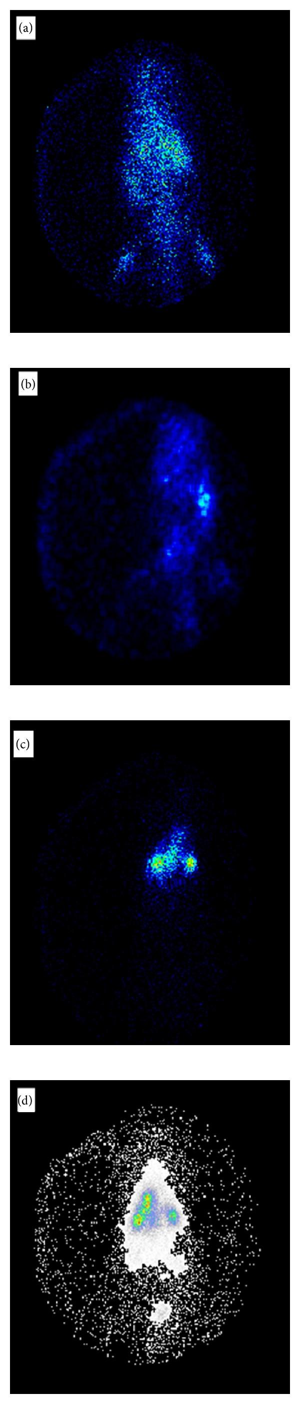 https://cdn.ncbi.nlm.nih.gov/pmc/blobs/eb48/3747341/4deb60d52755/BMRI2013-136859.003.jpg