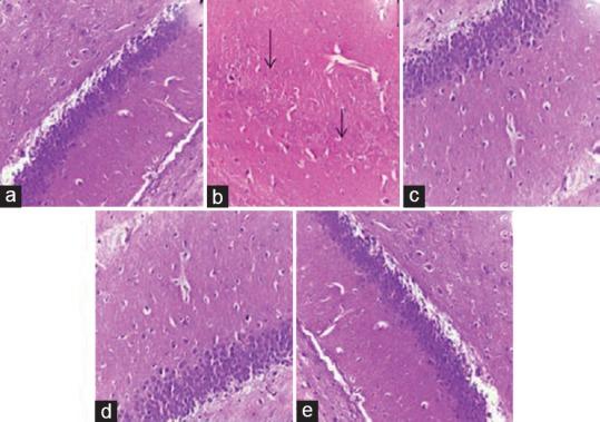 https://cdn.ncbi.nlm.nih.gov/pmc/blobs/eb48/5351240/a0bfea2d6324/IJPharm-49-60-g006.jpg