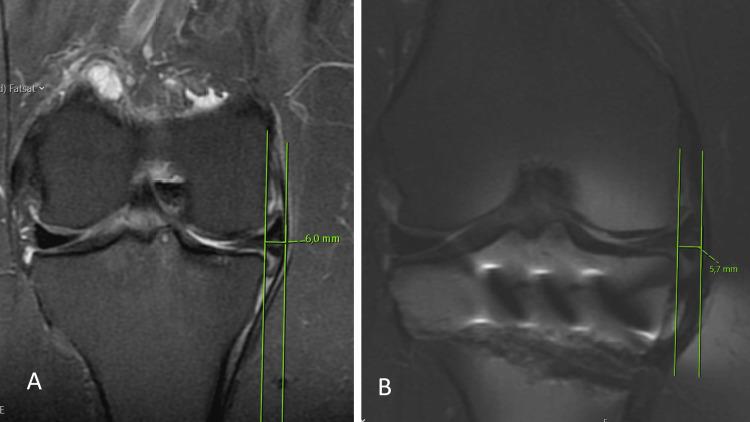 https://cdn.ncbi.nlm.nih.gov/pmc/blobs/eb49/10636517/c802b06f6f4d/cureus-0015-00000046884-i04.jpg
